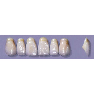 MYERSON ANTERIORS #A53/70 (1x6CARD) Card