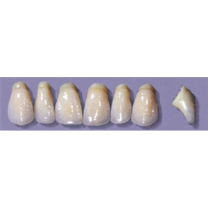 MYERSON ANTERIORS #PW8/G (1x6 CARD) Card